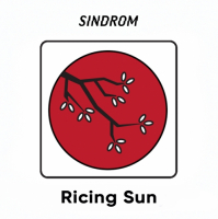 Пиво Ricing Sun