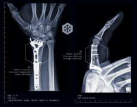 Пиво Granizo Fracture 22Ti